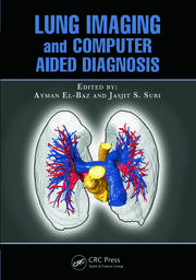 Lung Imaging and Computer Aided Diagnosis book cover