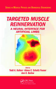 Targeted Muscle Reinnervation: A Neural Interface for Artificial Limbs book cover