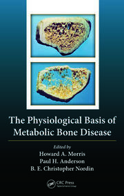 The Physiological Basis of Metabolic Bone Disease book cover