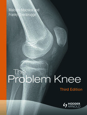 The Problem Knee book cover