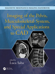 Imaging of the Pelvis, Musculoskeletal System, and Special Applications to CAD book cover