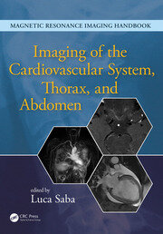 Imaging of the Cardiovascular System, Thorax, and Abdomen book cover