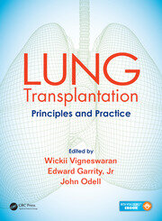 Lung Transplantation: Principles and Practice book cover