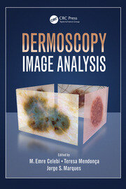 Dermoscopy Image Analysis book cover
