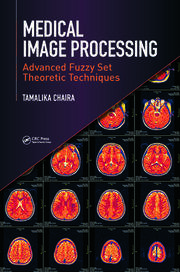 Medical Image Processing: Advanced Fuzzy Set Theoretic Techniques book cover