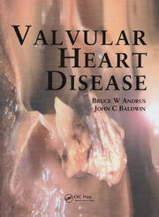 Valvular Heart Disease book cover