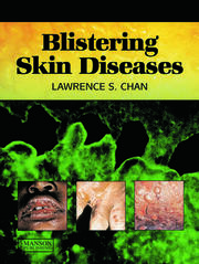 Blistering Skin Diseases book cover