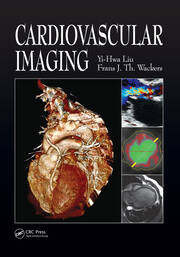 Cardiovascular Imaging book cover