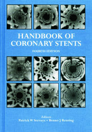 Handbook of Coronary Stents book cover