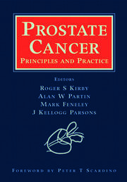 Prostate Cancer: Principles and Practice book cover