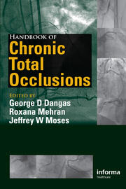 Handbook of Chronic Total Occlusions book cover