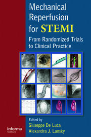Mechanical Reperfusion for STEMI: From Randomized Trials to Clinical Practice book cover