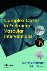 Complex Cases in Peripheral Vascular Interventions book cover