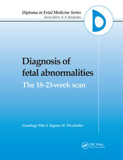 Diagnosis of Fetal Abnormalities: The 18-23-Week Scan book cover