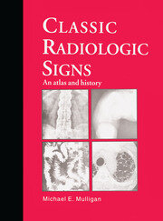 Classic Radiologic Signs: An Atlas and History book cover